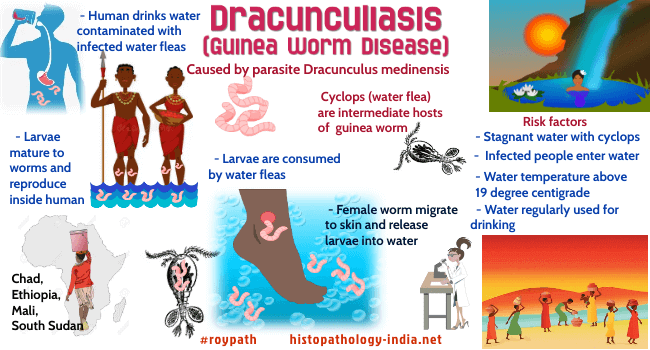 Pathology Of Dracunculiasis Guinea Worm Disease Dr Sampurna Roy MD