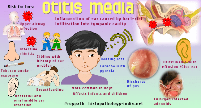 Pathology Of Otitis Media Dr Sampurna Roy Md